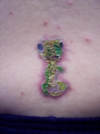 Infected tattoo Pictures, Images and Photos