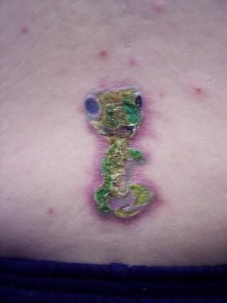 infected tattoo. Treat an Infected Tattoo